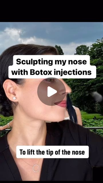 Enki Nichols | Lone Tree Aesthetics Med Spa | People have different opinions on what constitutes the perfect nose. This is my Botox Personal Plan for my own goals.  Botox provides sub... | Instagram Botox Nose Before After, Botox Nose, Nose Botox Before And After, Nose Filler Before After, Nose Filler, Botox Mapping, Botox For Nose Tip, Where To Get Botox On Face, Botox Before After