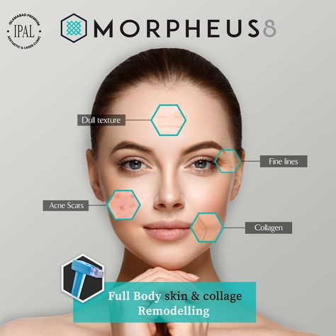 Morpheus 8, Laser Skin Rejuvenation, Creative Post, Skin Facts, Skin Aesthetics, Laser Clinics, Aesthetic Clinic, Beauty Clinic, Laser Skin