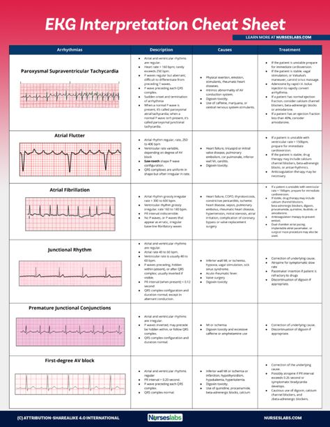 EKG Interpretation Cheat Sheet & Heart Arrhythmias Guide (2020 Update) Heart Rhythms Nursing, Arrhythmias Nursing Cheat Sheets, Paramedic Cheat Sheet, Nremt Study Cheat Sheets, Ekg Rhythms Cheat Sheets, Ekg Cheat Sheet, Easy Ekg Interpretation Cheat Sheets, Medicine Notes Cheat Sheets, Ekg Interpretation Made Easy Cheat Sheets