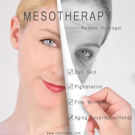 Mesotherapy Face, Face Scar, Parts Of Body, Anti Aging Hands, Derma Pen, Skin Pigmentation, Fine Wrinkles, Aging Face, Scar Removal