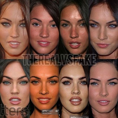 2000s Beauty Standards, Face Surgery Before And After, Face Botox Before And After, Lip Botox Before And After, Megan Fox Before After, Megan Fox Surgery, Veneers Before And After, Lip Filler Before And After, Before After Surgery