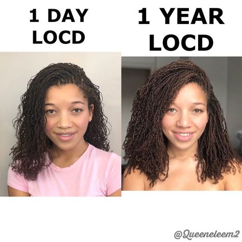 Frizzy Microlocs, 1 Year Locs Journey, Microlocs With Extensions, Microlocs With Shaved Sides, Microloc Inspiration, Dyed Microlocs, Long Micro Locs, Long Microlocs, Micro Locs Vs Sister Locs