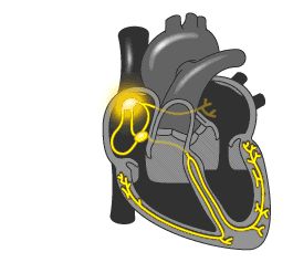 Vascular Concepts - State of the art Endovascular Devices Heart Nursing, Anatomy Heart, Cardiac Cycle, Heart Diagram, Heart Anatomy, Cardiac Nursing, Heart Function, Heart Pump, Nurse Stuff