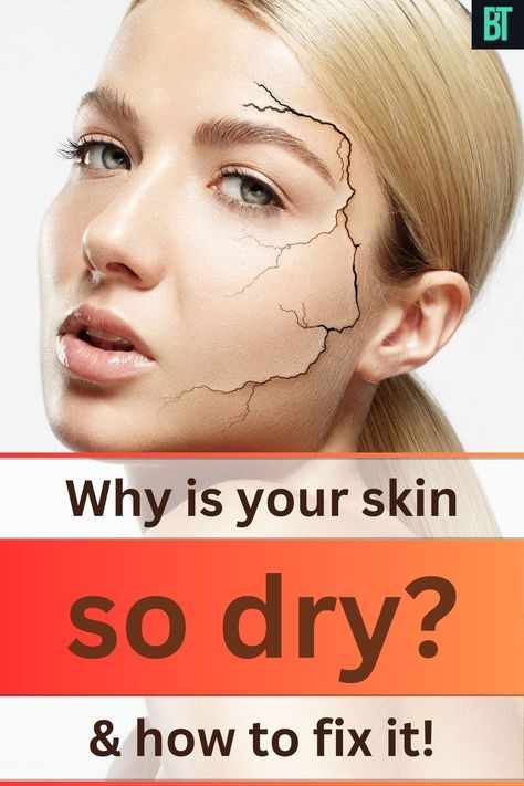 Get rid of dry skin with simple DIYs. Discover the ultimate guide to banishing so dry skin for good with our curated DIY home remedies and expert skincare tips. Dive into hydration! Transform your skin from parched to perfect! Explore our top DIY remedies and skin care tips specifically designed for so dry skin. #dryskin #skincaretips #fixdryskin #sodry #dryskincare Get Rid Of Dry Skin, Home Remedies For Warts, Warts Remedy, Natural Remedies For Migraines, Sunburn Relief, Dry Skin Remedies, Skin Natural Remedies, Dark Underarms, Top Diy