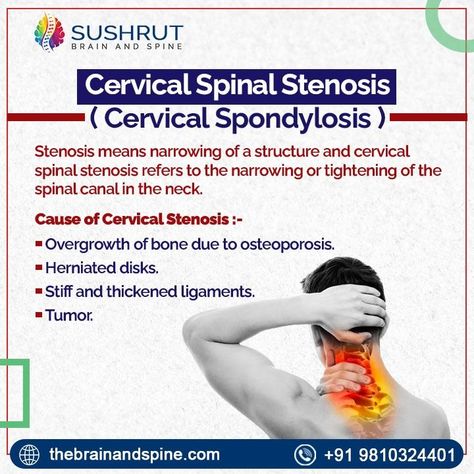 Spinal Canal Stenosis, Brain And Spine, Spine Care, Cervical Spondylosis, Spine Health, Neck Pain Relief, Neurological Disorders, Adrenal Fatigue, Invisible Illness