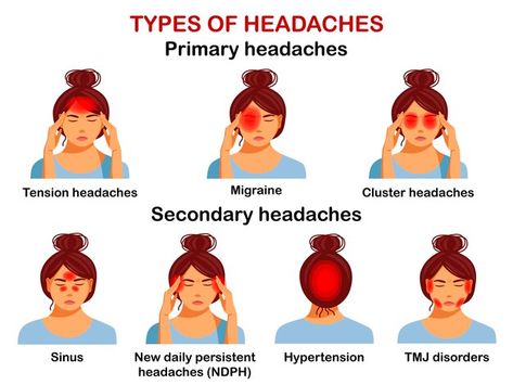 Types Of Headaches Chart, Headache Meaning, What Causes Headaches, Headache Chart, Neck Headache, Types Of Migraines, Headache Medicine, Forward Head Posture Exercises, Sinus Congestion Relief