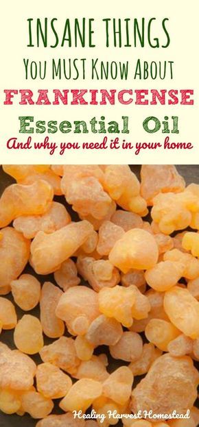 Why would anyone want to use frankincense essential oil? Find out the incredible benefits and uses of frankincense essential oil, PLUS how to use it. Why do you need Frankincense essential oil in your home? Find out all the things to know about Frankincense essential oil! Frankincense Essential Oil Benefits, Frankincense Essential Oil Uses, Amazing Easy Recipes, Essential Oil Remedy, Oil Remedies, Essential Oils Herbs, Frankincense Oil, Essential Oil Benefits, Healing Oils