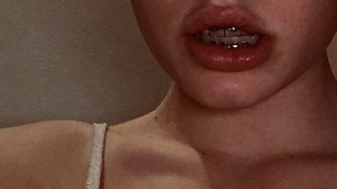 #aesthetic #lips #braces #teeth Brace Aesthetics, Teeth Braces Aesthetic, Bunny Teeth Aesthetic, Lips With Braces, Braces Aesthetic Girl, Crooked Teeth Aesthetic, Orthodontics Aesthetic, Aesthetic Braces, Brackets Aesthetic