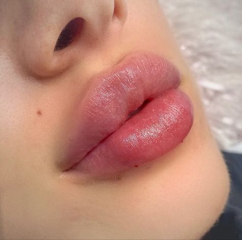 Lips Inspiration, Botox Lips, Sulam Alis, Facial Fillers, Facial Aesthetics, Lip Injections, Perfect Lips, Nose Job, Hot Lips