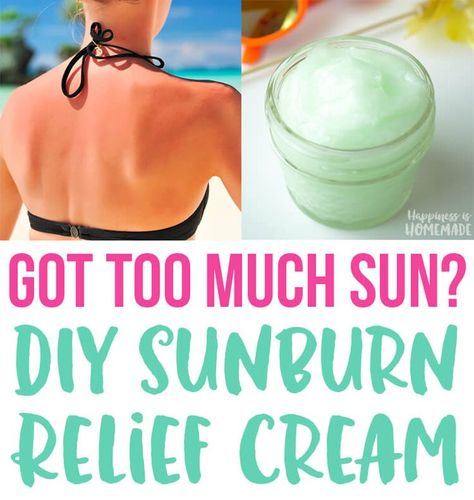 DIY Natural Sunburn Relief Cream - This soothing homemade sunburn relief cream cools and heals with coconut oil, aloe vera, lavender and peppermint – perfect if you’ve gotten too much sun! Diy Sunburn Relief, Sunburn Lotion, Sunburn Cream, Home Remedies For Sunburn, Natural Wart Remedies, Aloe Vera For Sunburn, Sunburn Peeling, Burn Relief, Sunburn Remedies