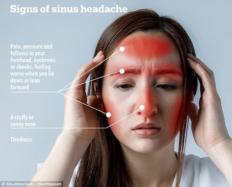 Sinus headaches often cause pain, pressure and a feeling of 'fullness' in the forehead Forehead Headache, Hangover Headache, Daily Headaches, Natural Headache, Sinus Pain, Migraine Attack, Headache Types, Sinus Headache, Headache Prevention