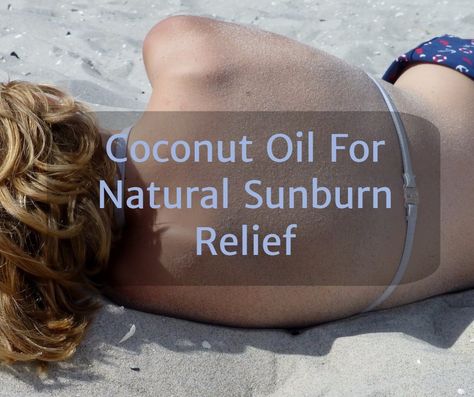 Coconut Oil For Natural Sunburn Relief Coconut Oil For Sunburn, Get Rid Of Sunburn, Sunburn Remedies, Sunburn Relief, Coconut Oil For Dogs, Natural Acne Remedies, Skin Natural Remedies, Coconut Oil Uses, Benefits Of Coconut Oil