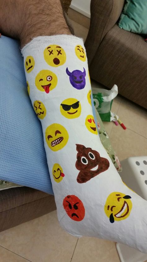 The first leg plaster Cast Decorating Ideas Leg, Hand Plaster Fracture, Leg Cast Decorating Ideas, Cast Drawing Ideas Arm, Cast Decoration, Cast Drawing, Kids Cast, Broken Ankle, Leg Cast