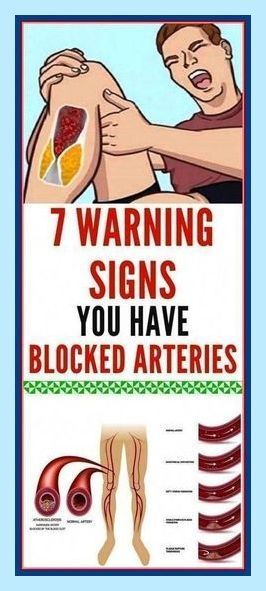 Here Are 7 Warning Signs You Have Blocked Arteries Bad Circulation, Poor Circulation, Women Health, Men's Health, Lose 50 Pounds, Lifestyle Tips, Stubborn Belly Fat, Health And Fitness Tips, Health Advice