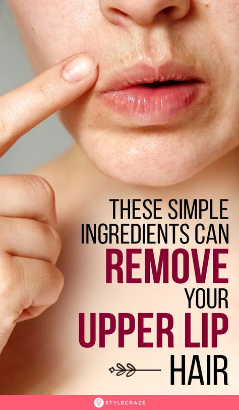 How To Remove Hair From Upper Lip, How To Naturally Remove Facial Hair, How To Get Rid Of Hair On Upper Lip, Removing Upper Lip Hair, Natural Upper Lip Hair Removal, Uper Lips Hair Remover At Home, Hair On Face Removal, Remove Mustache Hair Upper Lip, Facial Hair Removal For Women At Home