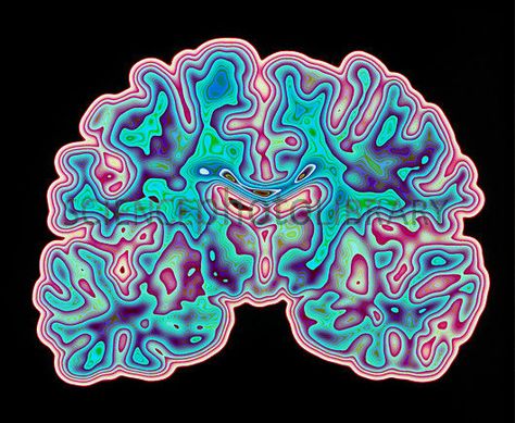 CT scan of brain. Skulle vara vackert på en kudde eller broderi! Male Figure Drawing, Brain Scan, Brain Art, The Human Brain, Bio Art, Psy Art, Human Figure Drawing, Ct Scan, Medical Art