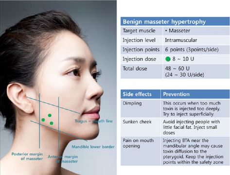 Facial Aging, Facial Anatomy, Botulinum Toxin, Skin Grafting, Facial Plastic Surgery, Facial Aesthetics, Facial Wrinkles, Botox Fillers, Aesthetic Medicine