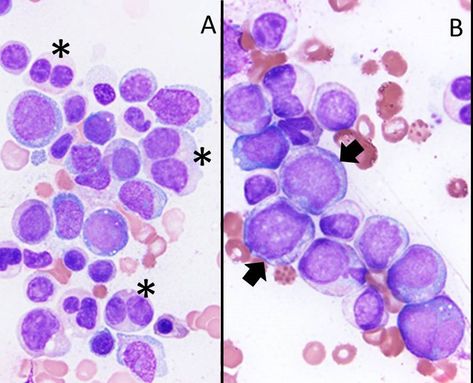 Myelodysplastic Syndrome, Chromosomal Abnormalities, Blood And Bone, Stem Cells, Old Paper, Authors