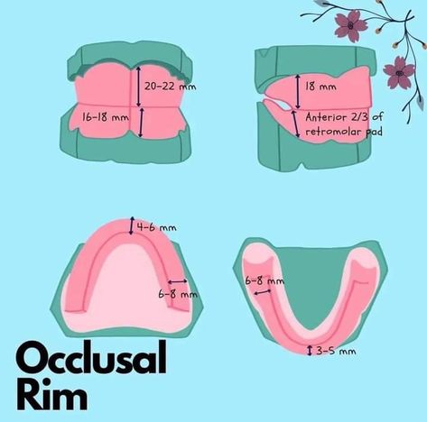 Complete Denture Prosthodontics, Prosthodontics Dentistry, Artificial Teeth, Dental Lab Technician, Dental Dentures, Dental Pictures, Dental Assistant Study, Dental Hygiene Student, Holistic Dentistry