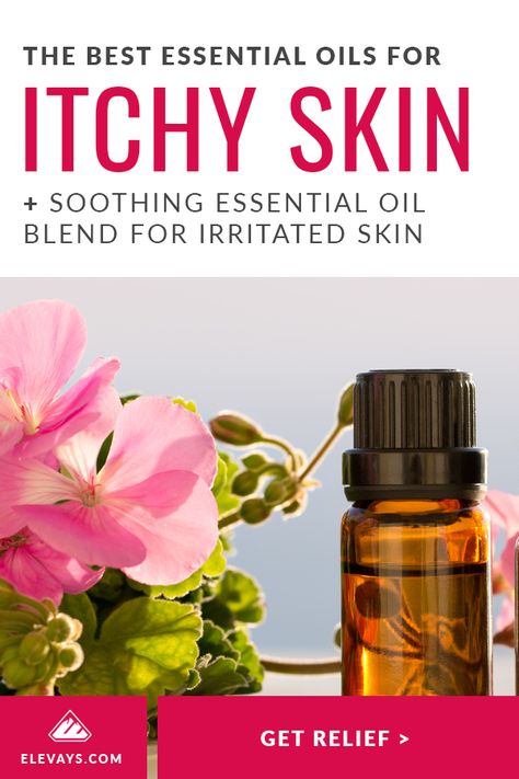 Essential Oils Itchy Skin, Itchy Skin Remedies, Essential Oil Spray Recipes, Itchy Skin Relief, Essential Oil Mixtures, Doterra Blends, Esential Oils, Roller Blends, Oils Essential