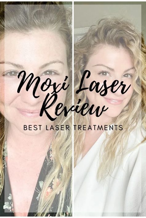 Extra LSR: Skin Resurfacing with MOXI Laser. | Le Stylo Rouge Moxi Laser Before And After, Under Eye Color Corrector, Cerave Moisturizer, Face Laser, Laser Skin Care, Laser Skin Resurfacing, Laser Resurfacing, Skin Resurfacing, Laser Skin