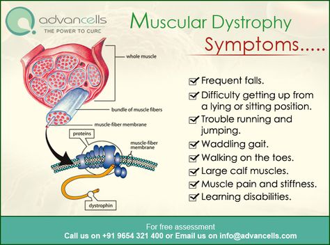 Muscular Dystrophy Symptoms, Neurology Nursing, Neonatal Nursing, Duchenne Muscular Dystrophy, Muscular Dystrophy, Neonatal Nurse, Nursing Notes, Calf Muscles, Med School