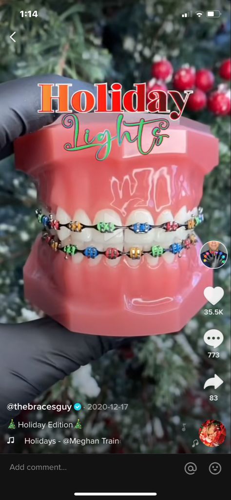 Christmas Braces Colors Ideas, Braces Combo Colors, October Braces Colors, Braces Colors Christmas, Holiday Braces Colors, Braces Colors For Christmas, Christmas Braces Color Ideas, Winter Braces Colors, Halloween Braces Colors