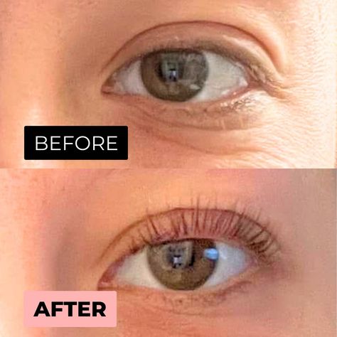 Check out this amazing before and after results from using our at-home lash lift kit! 😆✨ 💖 Natural Eyelash Growth, Lash Lift Kit, Eyebrow Growth, Brow Serum, Eyelash Lift, Eyelash Growth Serum, Eyelash Serum, Lash Serum, Eyelash Growth