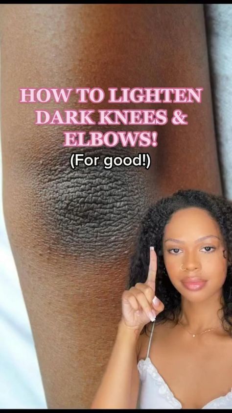 Dark Knees, Haut Routine, Skin Advice, Clear Healthy Skin, Natural Face Skin Care, Serious Skin Care, Women Hairstyles Medium, Basic Skin Care Routine, Clear Skin Tips