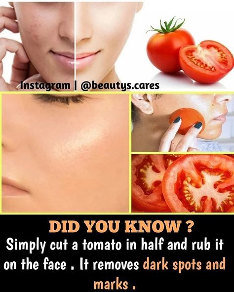 Remove Darkness Around Mouth, Darkness Around Mouth, Skin Care Home Remedies, Natural Skin Care Ingredients, Clear Healthy Skin, Natural Skin Care Remedies, Natural Face Skin Care, Good Skin Tips, Skin Care Face Mask