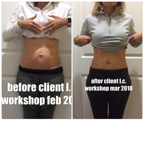 before and after pics – Beautiful After the Belly Pelvic Floor Before And After, Mom Belly Before And After, Flared Ribs Before And After, Rib Flare Before And After, Diastasis Recti Before After, Mummy Tummy, Mom Belly, Before And After Pics, Body Mechanics