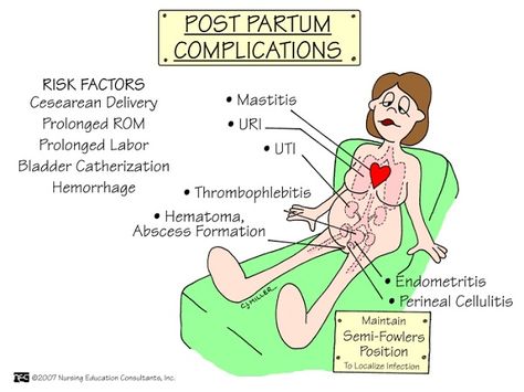 Nursing Mnemonics & Tricks (Obstetrics and Newborn Care) | NurseBuff Heart Nursing, Newborn Nursing, Postpartum Nursing, Child Nursing, Labor Delivery Nursing, Independent Day, Ob Nursing, Nursing Mnemonics, Nursing Schools