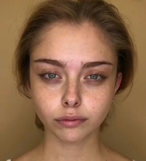 Beautiful Insecurities Eye Bags, Sick Beauty Aesthetic, Dark Eye Circles Aesthetic, Makeup With Eyebags, Eyebags Makeup Aesthetic, Tired Aestethic Eyes, Sunken Eyes Aesthetic, Sick Girl Makeup, Tired Makeup Look Under Eyes