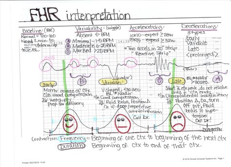 Fetal Heart Rate