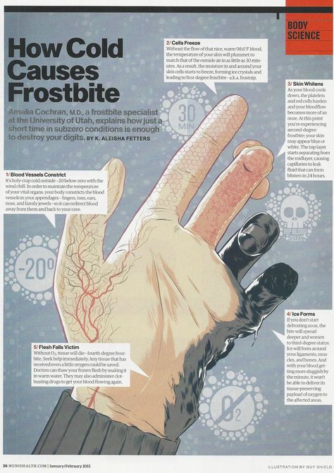 How cold causes frostbite in @menshealthmag Ice Burn On Skin, Frostbite Aesthetic, Cold Weather Running, Creative Writing Tips, Running In Cold Weather, Writing Inspiration Prompts, Book Writing Tips, Forensic, Running Tips