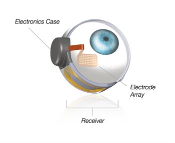 FDA Approves World's First Artificial Retina - The American Society of Retina Specialists Bionic Eye, Prosthetic Device, Eye Firming, Eye Center, Eyes Problems, Smart Glasses, E Mc2, February 15, Cool Tech