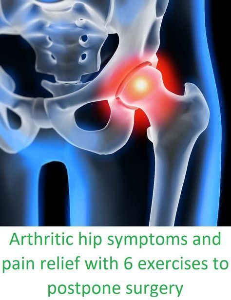 Arthritic hip symptoms and pain relief with 6 exercises to postpone surgery Best Exercise For Hips, Osteoporosis Exercises, Bursitis Hip, Arthritic Pain, Hip Pain Relief, Hip Problems, Pain Relief Remedies, Lower Back Pain Exercises, Physical Therapy Exercises