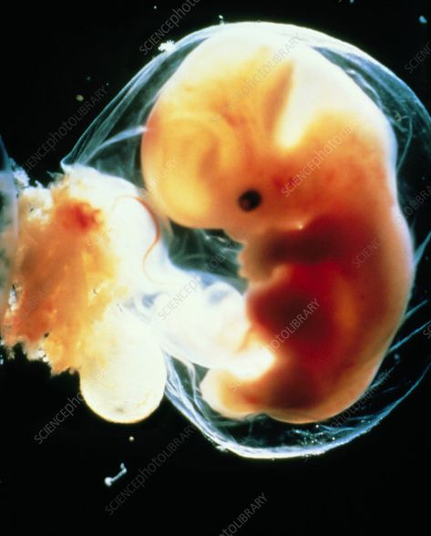 Human embryo 5-6 weeks after fertilisation - Stock Image - P680/0244 Spirals In Nature, Space Exploration Technologies, Human Embryo, Science Photos, Dragon Egg, Photo Library, Buy Prints, Image House, Fertility