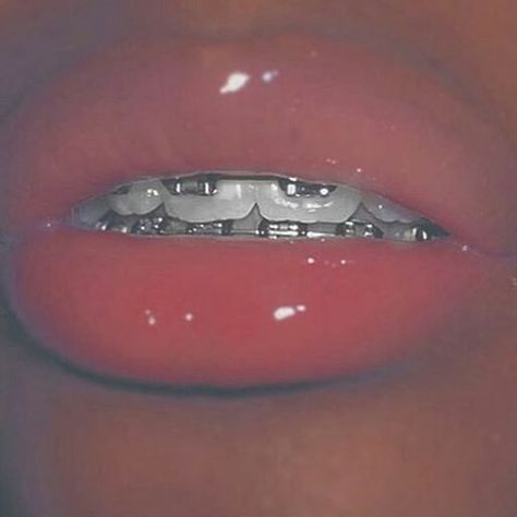 Cute Braces Colors, Braces Tips, Getting Braces, Braces Girls, Cute Braces, Brace Face, Braces Colors, Dental Braces