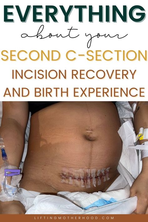 Post Partum Recovery C Section, Second C Section, C Section Hairstyles, C Section Post Partum Workout, C Section Pictures, C Section Post Partum Essentials, C Section Post Partum, Post Partum C Section, C-section