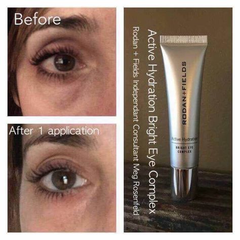 Get instant gratification with this incredible eye cream Rodan Fields Skin Care, Dry Under Eyes, Rodan And Fields Consultant, Hydrating Eye Cream, Dark Eye Circles, Under Eye Puffiness, Best Eye Cream, Remove Dark Circles, Dark Circles Under Eyes