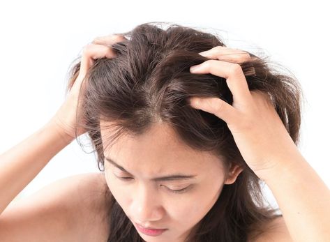 **6 Reasons Why Your Scalp is Itchy and What to Do About It** In the winter time, it is not uncommon for your skin to itch. The dry weather and, depending on where you live, the cold conditions can make your skin dry, itchy and uncomfortable. In this article, we are going to explore the most common reasons that you may be experiencing an itchy scalp and what you can do about it. Losing Hair Women, Bad Wigs, Thin Hair Styles For Women, Itchy Scalp, Lost Hair, Hair Thickening, Hair Growth Tips, Natural Beauty Tips, Hair Regrowth