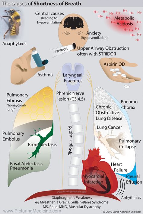 Shortness Of Breath Causes, Medic School, Student Paramedic, Emt Study, Nursing Labs, Guillain Barre, Basal Ganglia, Ulnar Nerve, Pulmonology