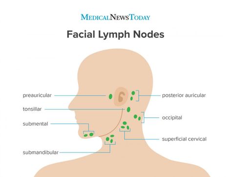 Salivary Gland Infection, Remedy For Sinus Congestion, Home Remedies For Sinus, Sinus Congestion Relief, Lymph Node, Parotid Gland, Lymph Glands, Lymph Vessels, Lymph Fluid