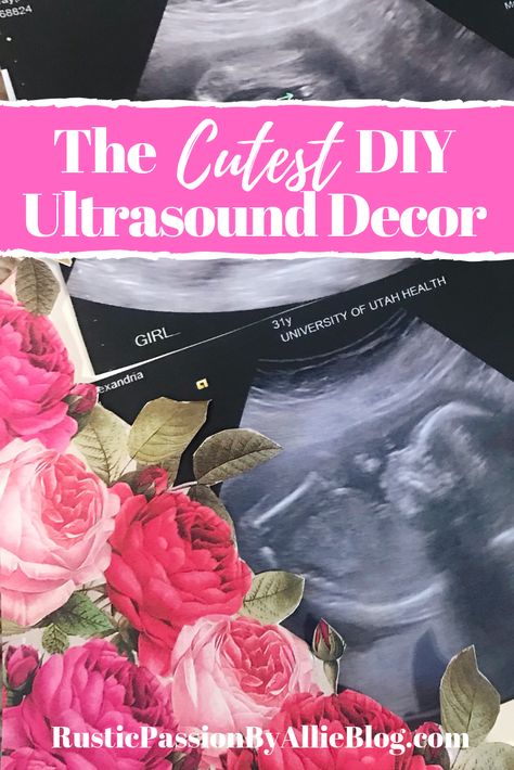 This is the cutest idea to display your ultrasound pictures. Whether you are looking for ultrasound announcement ideas, baby shower decor ideas, or just a fun DIY nursery decoration this is it. It's a great way to have a keepsake from your pregnancy you can display in your home. #nurserydecor #pregnancyannouncement #ultrasoundpictures #babyannouncement #diynurserydecor Ultrasound Room Decor, Display Ultrasound Pictures, Ideas For Ultrasound Pictures Display, What To Do With Sonogram Pictures, What To Do With Ultrasound Pictures, Ultra Sound Picture Ideas, Ultrasound Keepsake Ideas, Sonogram Picture Ideas Display, Ultrasound Pictures Display