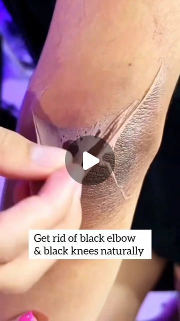 Pihu officials on Instagram: "Get Rid of Dark Elbow/Knees Naturally   . . . #darkelbows #dark #viralreels #trandingreels #skincareblogger #skincare #darkknees #darkelbowandknees #instagramreels #instagood" Skin Tan Removal, Cracked Heel Remedies, Dark Spots On Legs, Dark Elbows, Diy Skin Care Routine, Dark Underarms, Dark Spots On Skin, Beauty Tips For Glowing Skin, Perfect Skin Care Routine