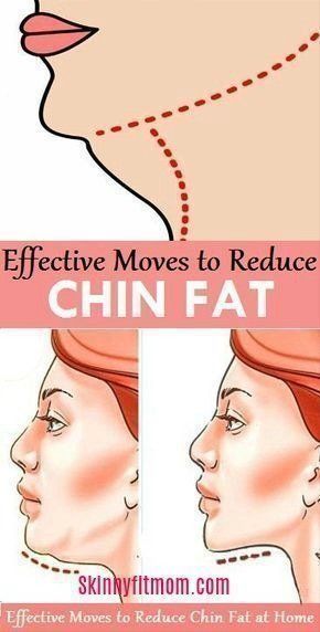 https://youtu.be/isow8Yo-uRU Fitness,Facts,Future,how to remove double chin,how to remove double chin in 2 days,how to remove double chin and face fat,how to remove double chin fast,double chin exercise,how to reduce cheek fat,double chin removal,double chin massage,double chin exercises before and after,double chin removal machine,get rid double chin fast,double chin,how to get rid of a double chin,double chin exercises,how to lose a double chin,jawline exercises,how to reduce double chin Být Fit, Double Chin Exercises, Reduce Double Chin, Chin Exercises, Double Menton, Neck Exercises, Face Exercises, Facial Exercises, Face Yoga