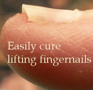 nail infection remedy Nail Bed Damage, Fingernail Health, Nail Disorders, Nail Remedies, Fingernail Fungus, Nail Problems, Nail Fungus Remedy, Nail Infection, Fungal Nail