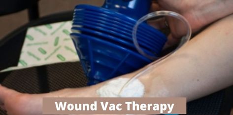 Wound Vac, Canoga Park, Best Vacuum, Wound Care, Vacuum Tube, Wound Healing, Medicine, Healing, How To Apply