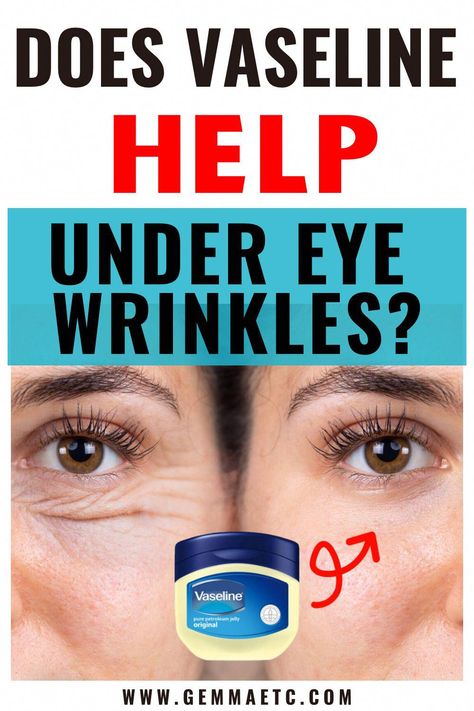 Does Vaseline help wrinkles under eyes? How to use Vaseline for the TikTok under-eye wrinkles hack! Say goodbye to eye bags & dark circles! Vaseline Under Eyes, Vaseline Uses For Face, Eye Wrinkles Remedies, Wrinkles Remedies Face, Home Remedies For Wrinkles, Vaseline Uses, Vaseline Petroleum Jelly, Eye Wrinkles, Wrinkle Remedies